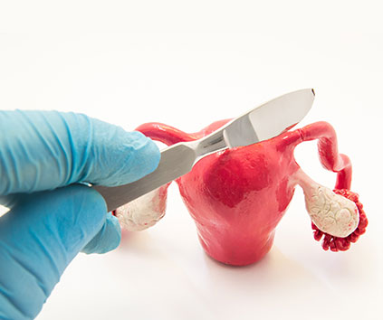 Surgeon performing laparoscopic procedure on female reproductive organs showing uterus, ovaries, and fallopian tubes with surgical instruments