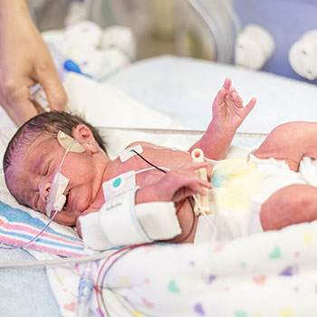 Neonatal intensive care specialist monitoring a baby on oxygen support inside the PICU