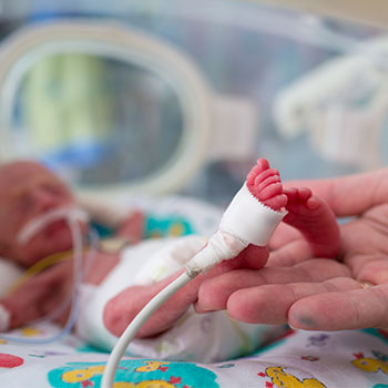 Premature newborn baby in NICU receiving medical care with oxygen support and monitoring equipment